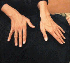 HANDSPIC.gif (29850 bytes)